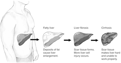 liver cadmium adiponectin fibrosis